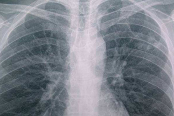 ��ְ�����Ŀ����Щ ��ְ�����Ŀ����